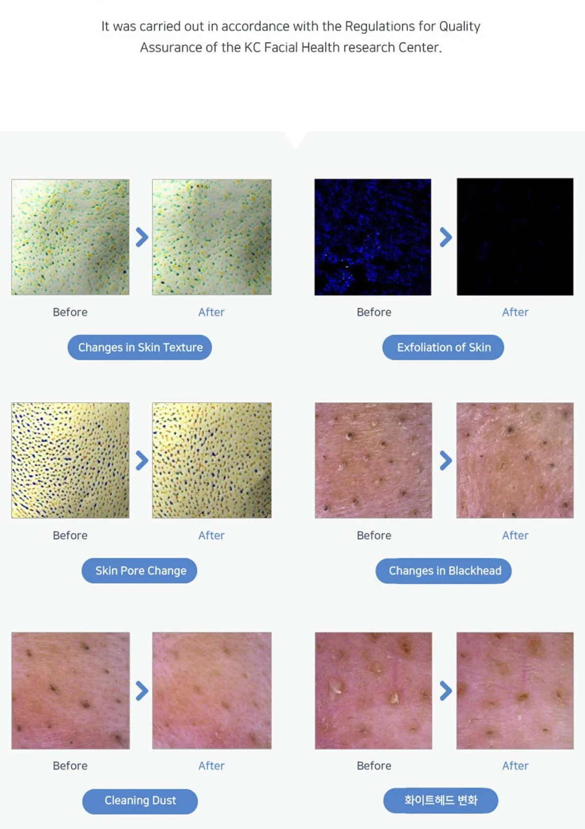 [ABELUNA] Aqua Peel M-200 - Image 9