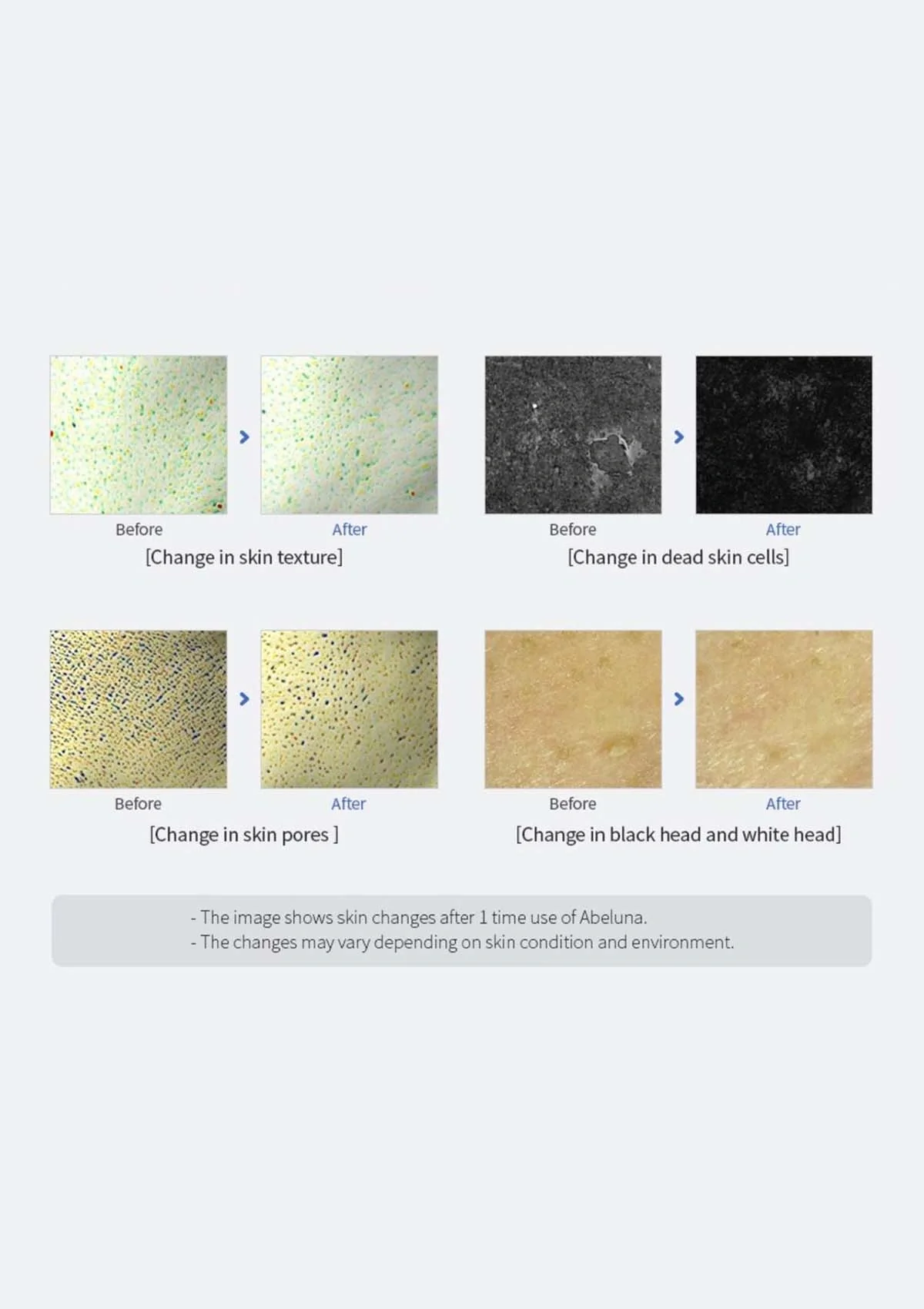 [ABELUNA] Aqua Peeling Solution 500ml - Image 10