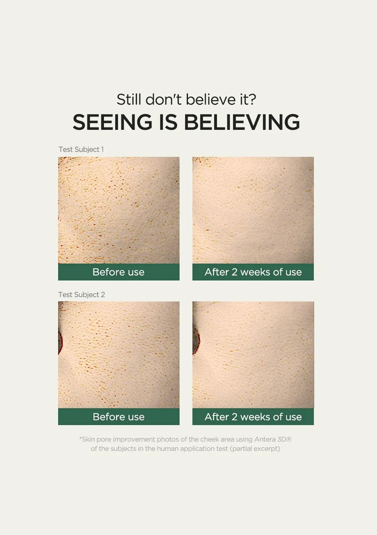 [ANUA] Heartleaf 77% Clear Pad 160ml - Image 7