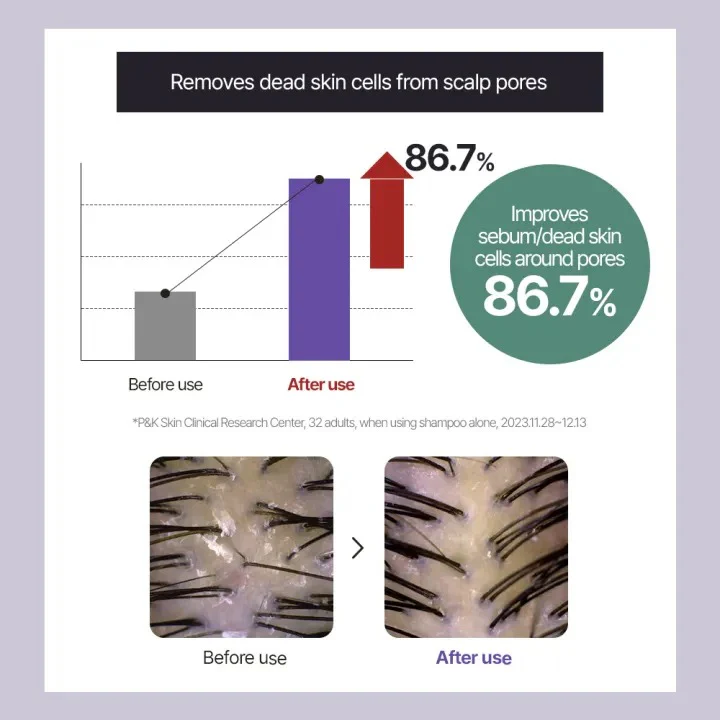 [DR. GROOT] Multi-Perfection Hair Loss Care Shampoo For Oily Scalp 400ml - Image 3