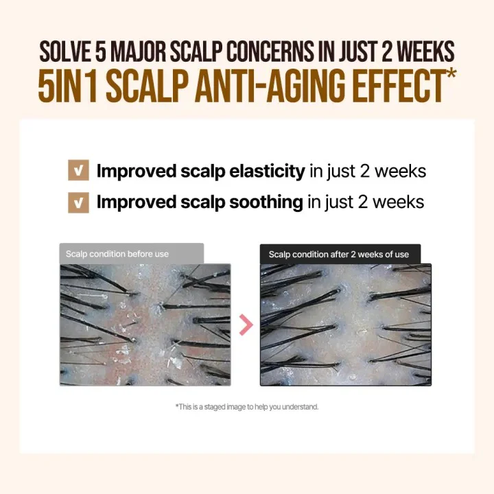 [DR. GROOT] Multi-Perfection Hair Loss Care Line - Image 46