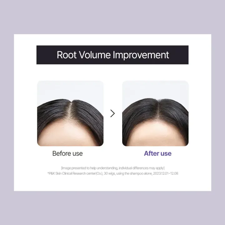 [DR. GROOT] Multi-Perfection Hair Loss Care Line - Image 8