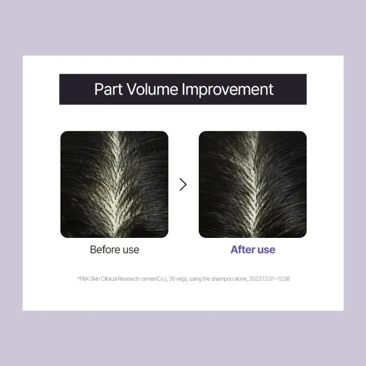 [DR. GROOT] Multi-Perfection Hair Loss Care Line - Image 9