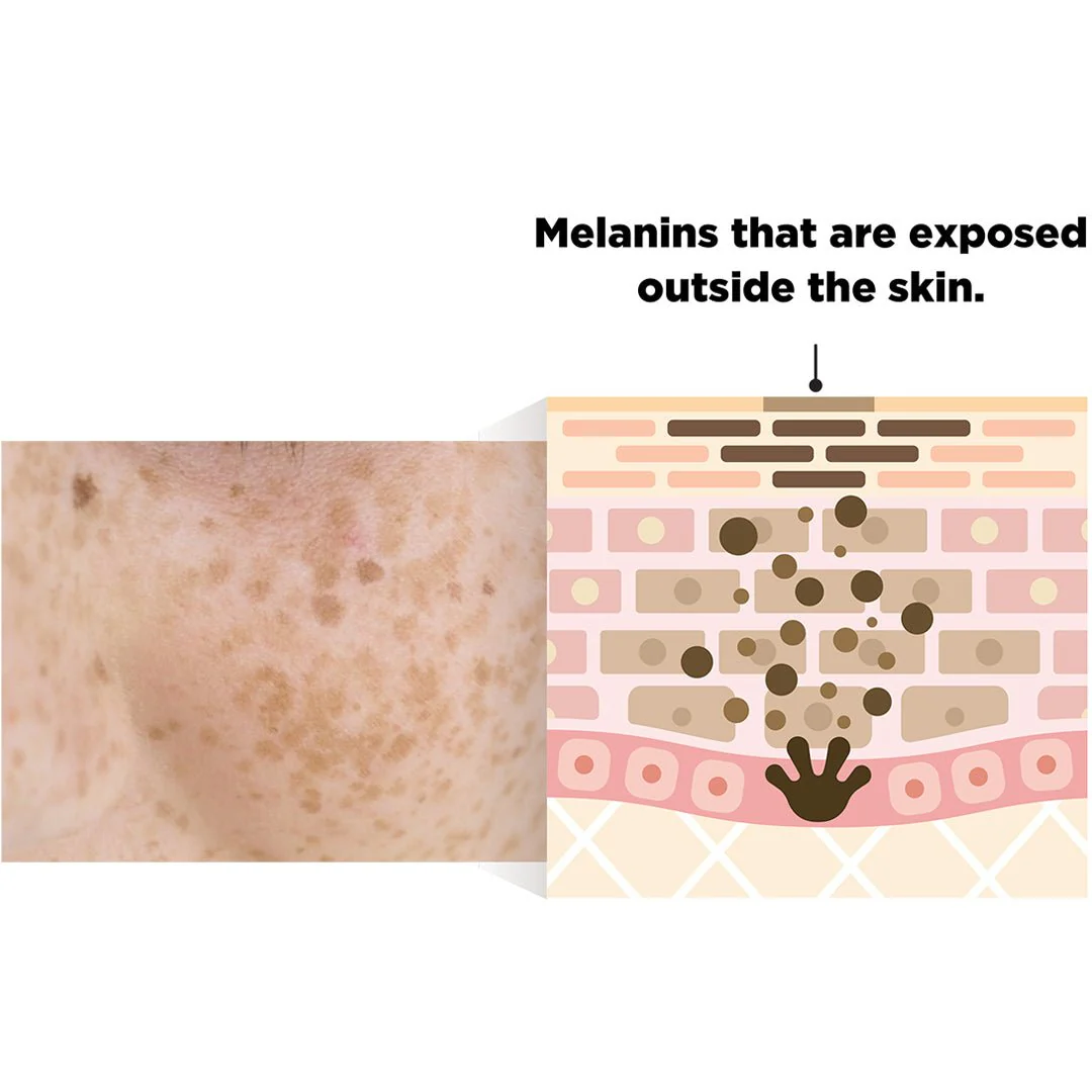 [FINDIVE] Bakuchiol Toning Ampoule 30ml - Image 12