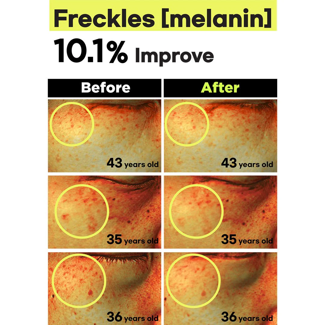 [FINDIVE] Bakuchiol Toning Ampoule 30ml - Image 13