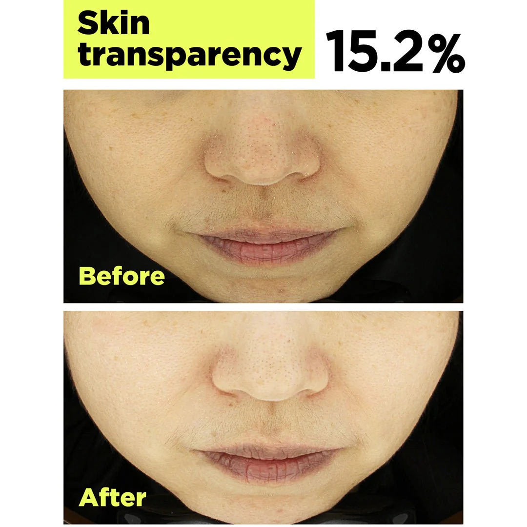 [FINDIVE] Bakuchiol Toning Ampoule 30ml - Image 5