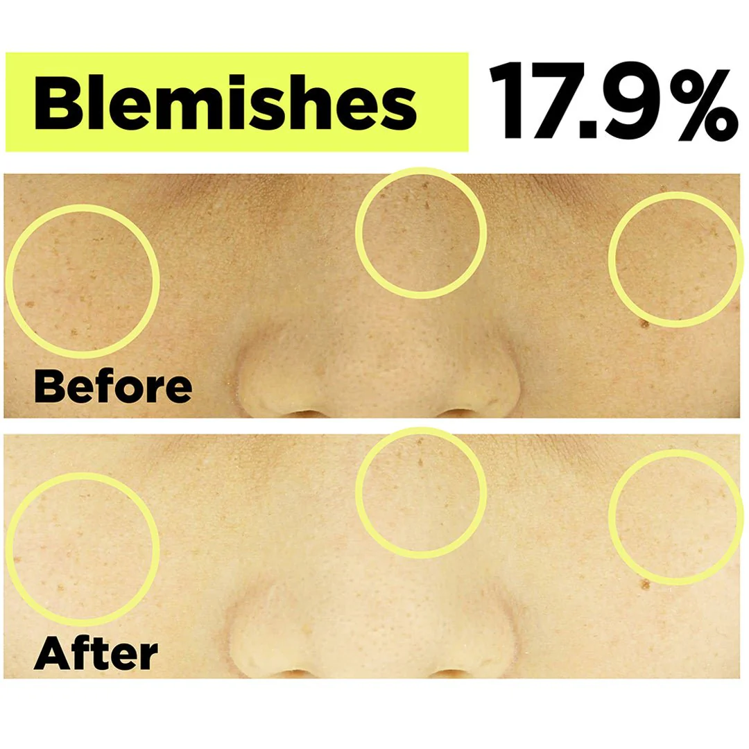 [FINDIVE] Bakuchiol Toning Ampoule 30ml - Image 6