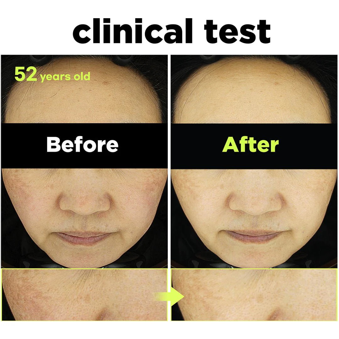 [FINDIVE] Bakuchiol Toning Ampoule 30ml - Image 8