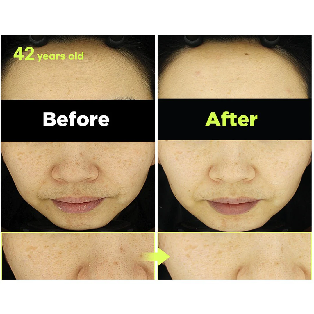 [FINDIVE] Bakuchiol Toning Ampoule 30ml - Image 9