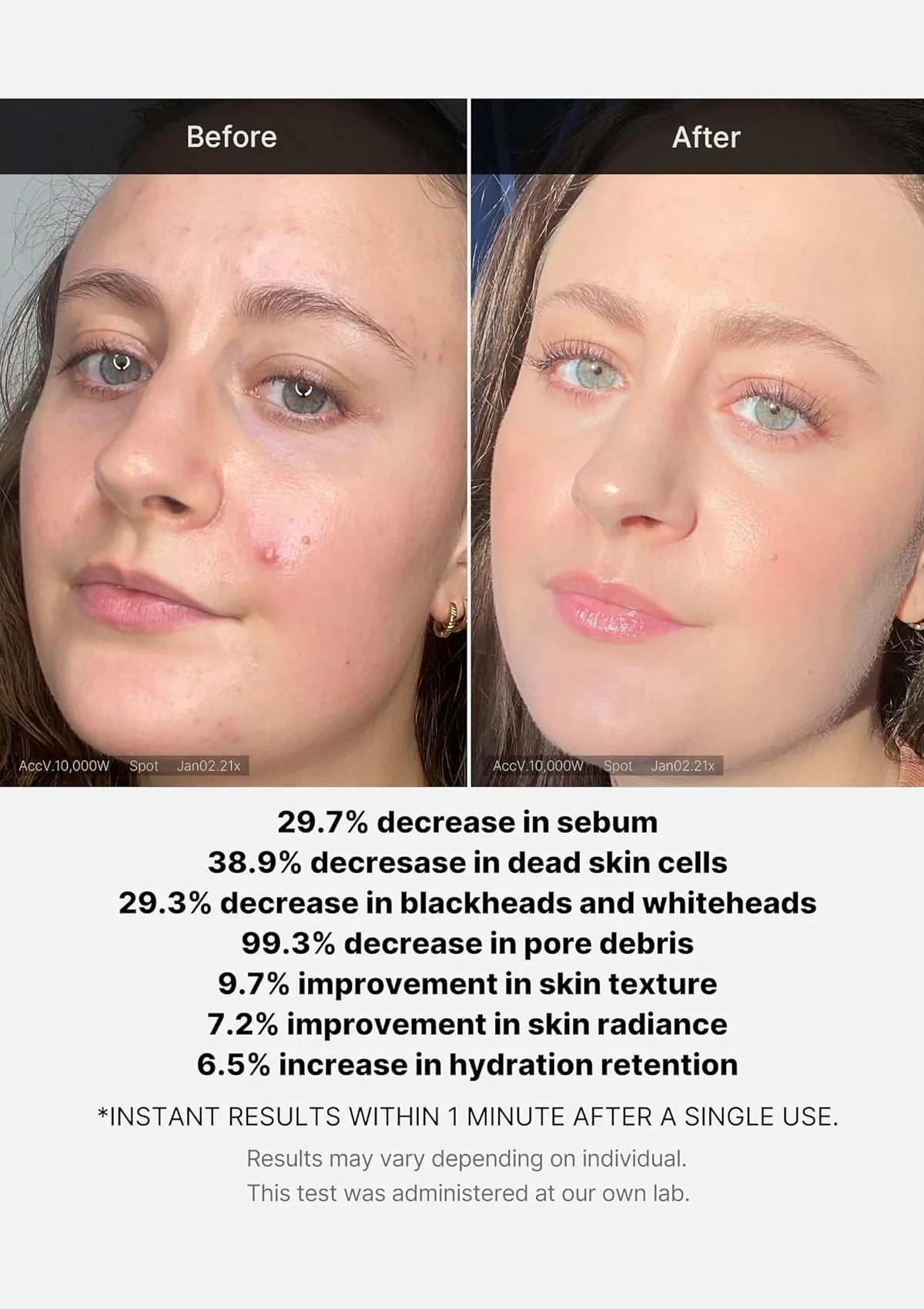 [MEDICUBE] Red Acne Succinic Acid Peel 40g - Image 7