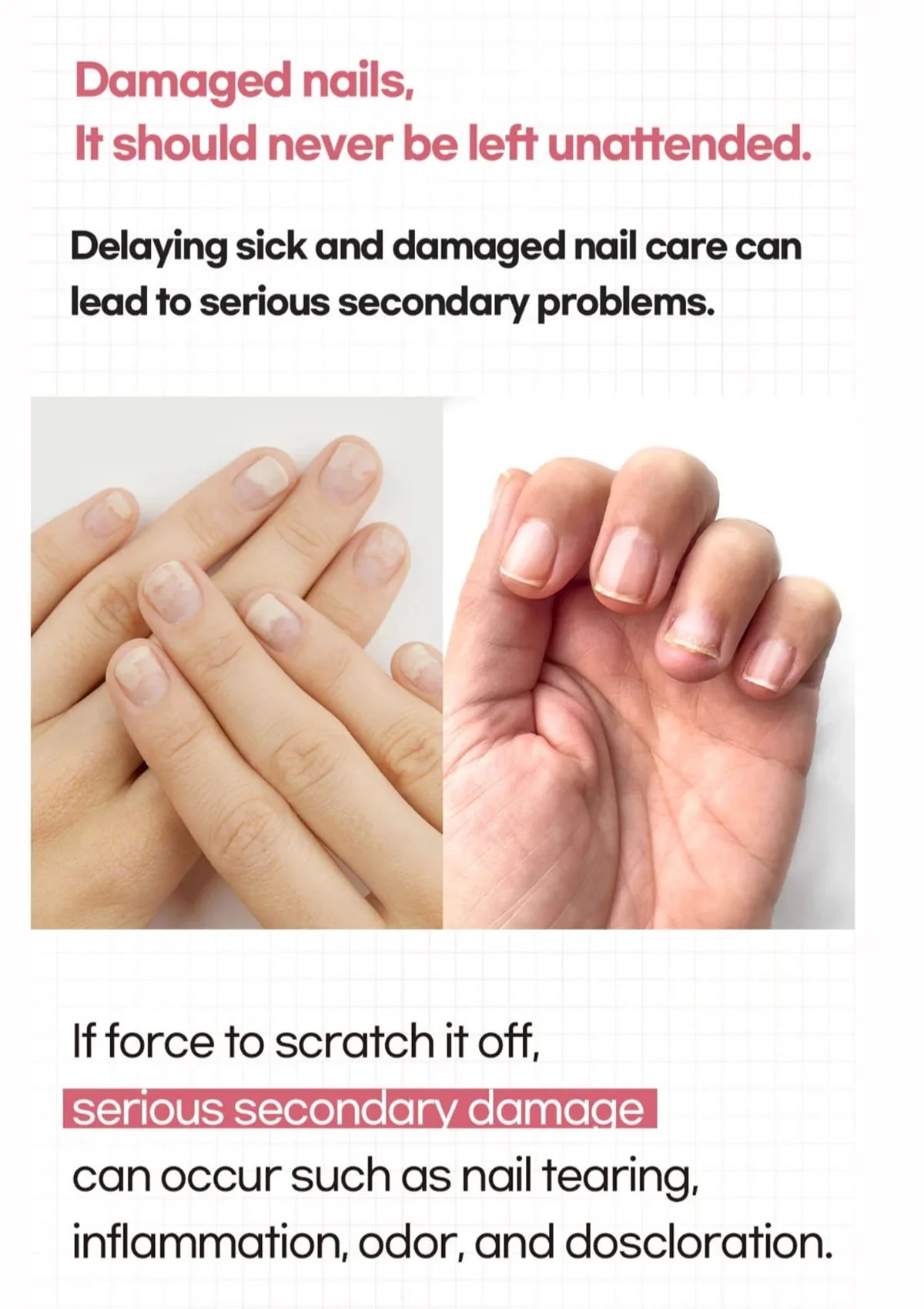 [SL LIGHT] Keratin Defense Nail Patch - Image 7