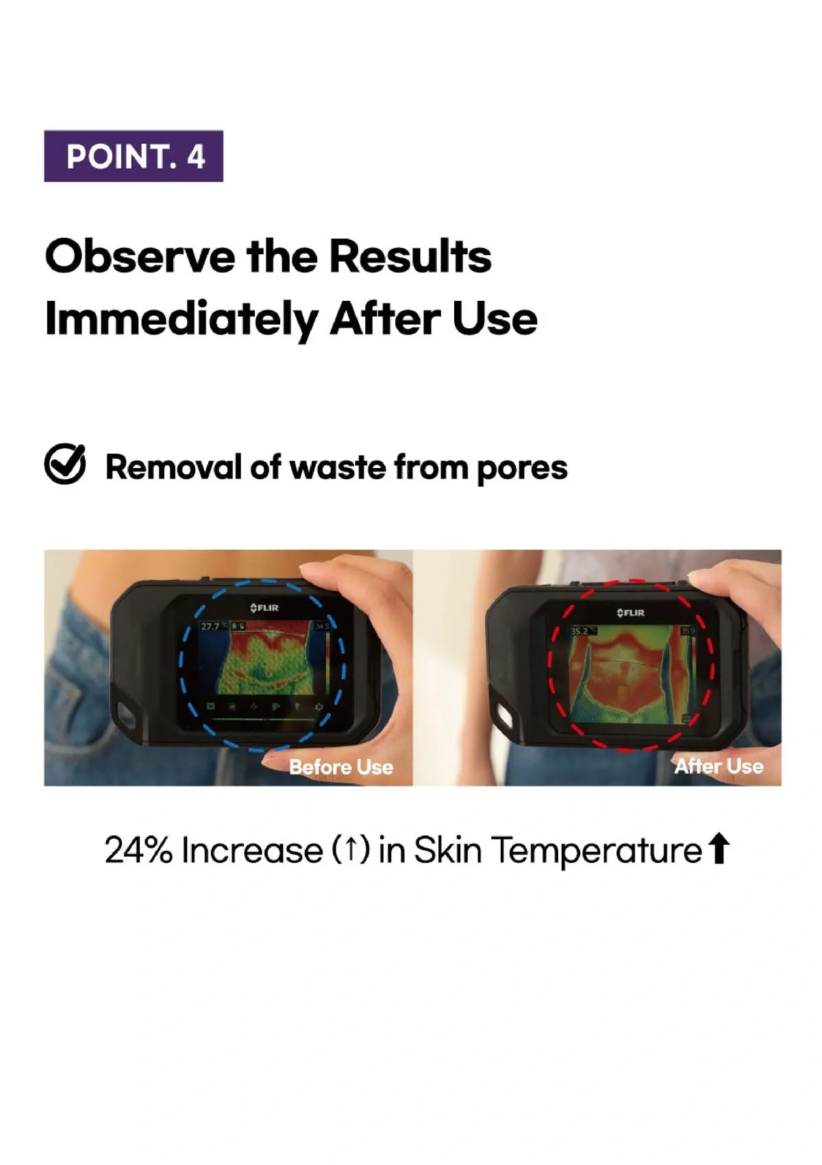 [SL LIGHT] Belly Patch | Multi Patch - Image 12