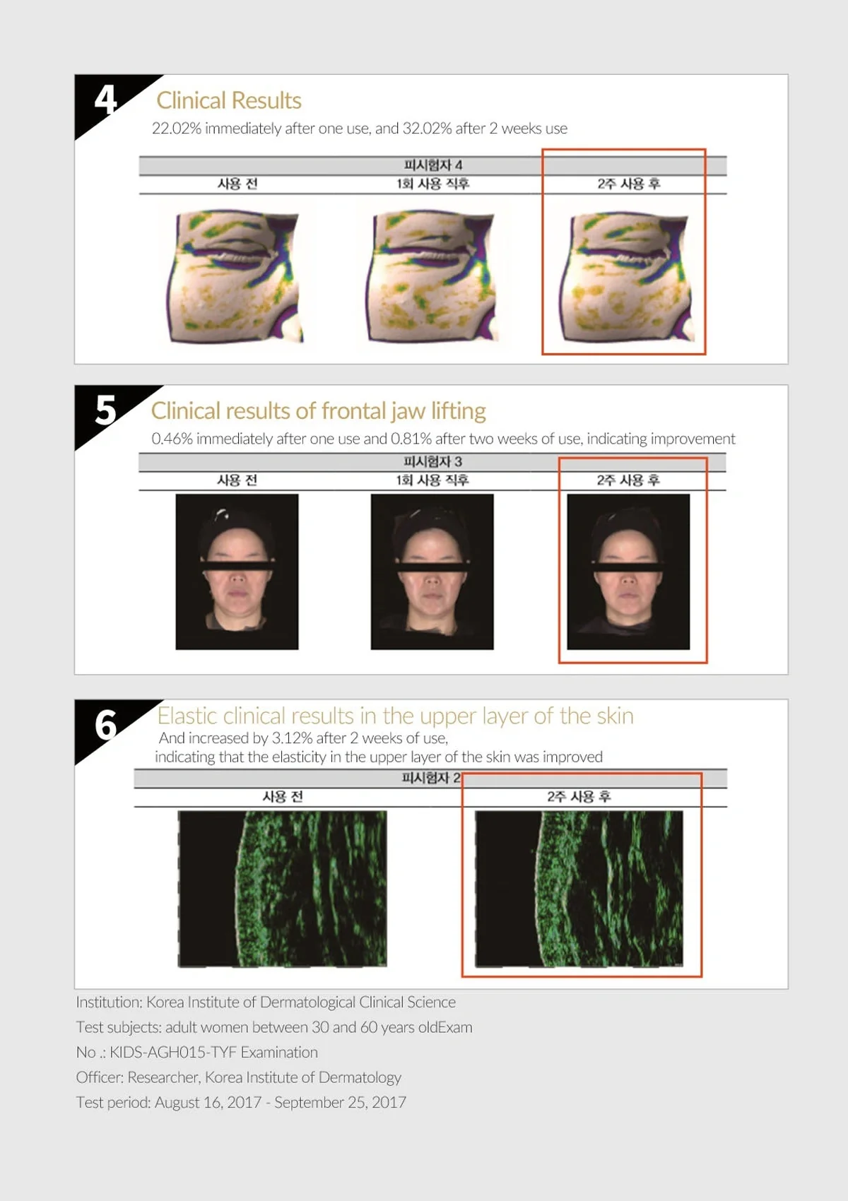 [THE YUFIT] Signature Lifting V Care 4D Band - Image 8